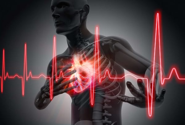 💔 C’est quoi exactement un infarctus ?